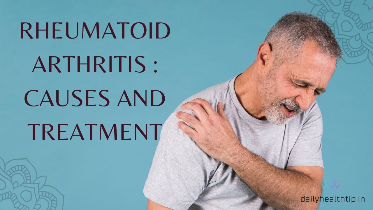 Rheumatoid Arthritis :Causes , Symptoms and Treatment